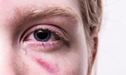 Trauma i identitet