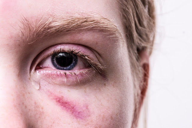 Trauma i identitet