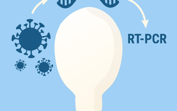 RT-qPCR: kako se radi PCR retrovirusa i RNK virusa?