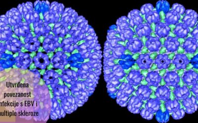 Naučnici s Harvarda: Epstein-Barrov virus povezan s multiplom sklerozom