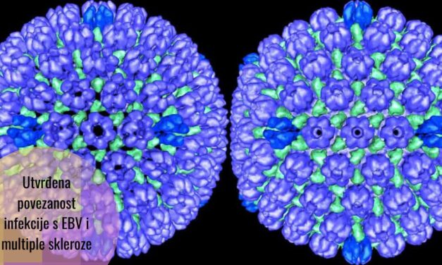 Naučnici s Harvarda: Epstein-Barrov virus povezan s multiplom sklerozom