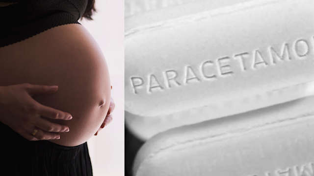 Prenatalna izloženost paracetamolu potencijalno povećava rizik od ADHD?