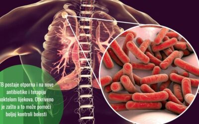 Nauka otkriva nove oblike tuberkuloze otporne na antibiotike, ali nudi i rješenja borbe protiv njih