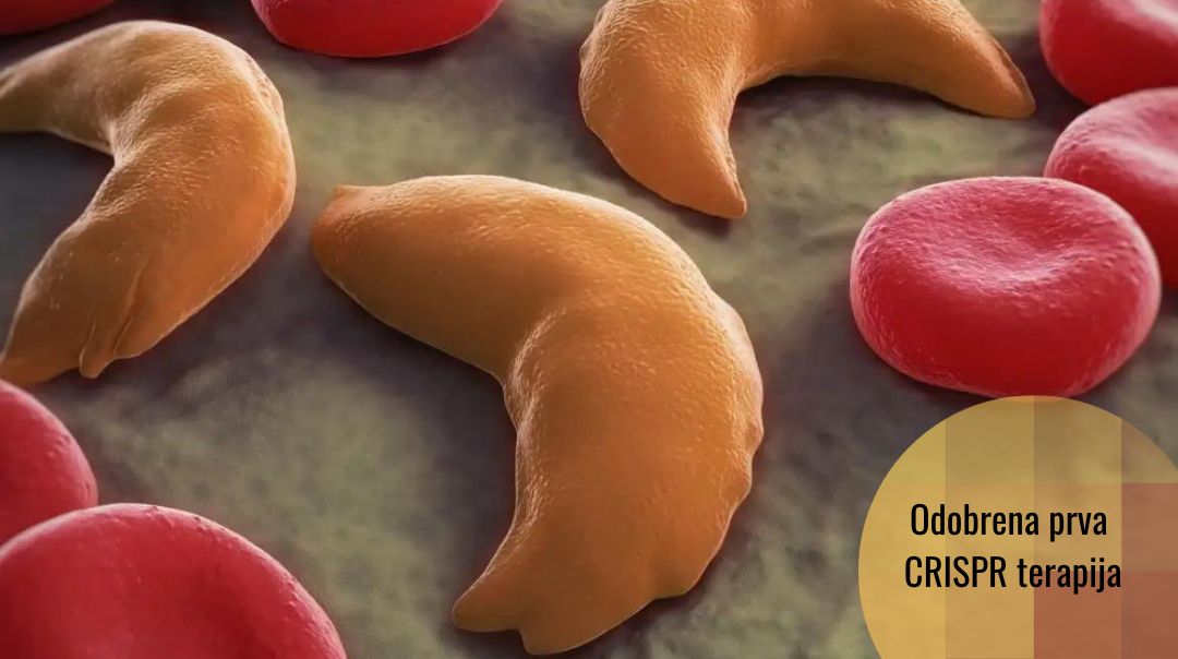 U UK odobrena genska terapija zasnovana na CRISPR: Casgevy