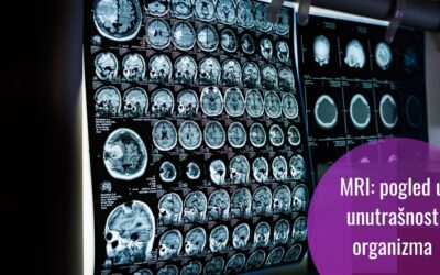 Razotkrivanje misterija organizma: kako funkcionira MRI?