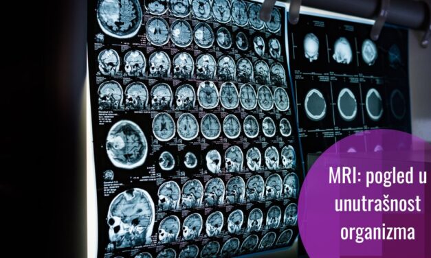 Razotkrivanje misterija organizma: kako funkcionira MRI?