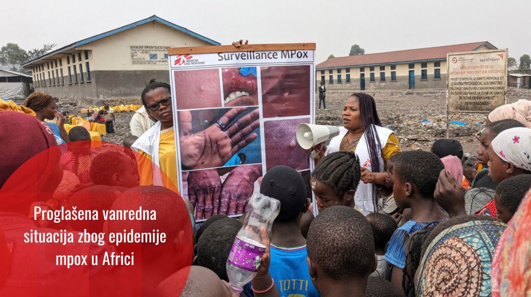 WHO proglasila globalnu vanrednu situaciju zbog nove epidemije Mpox: pitanja zdravstvene pravde
