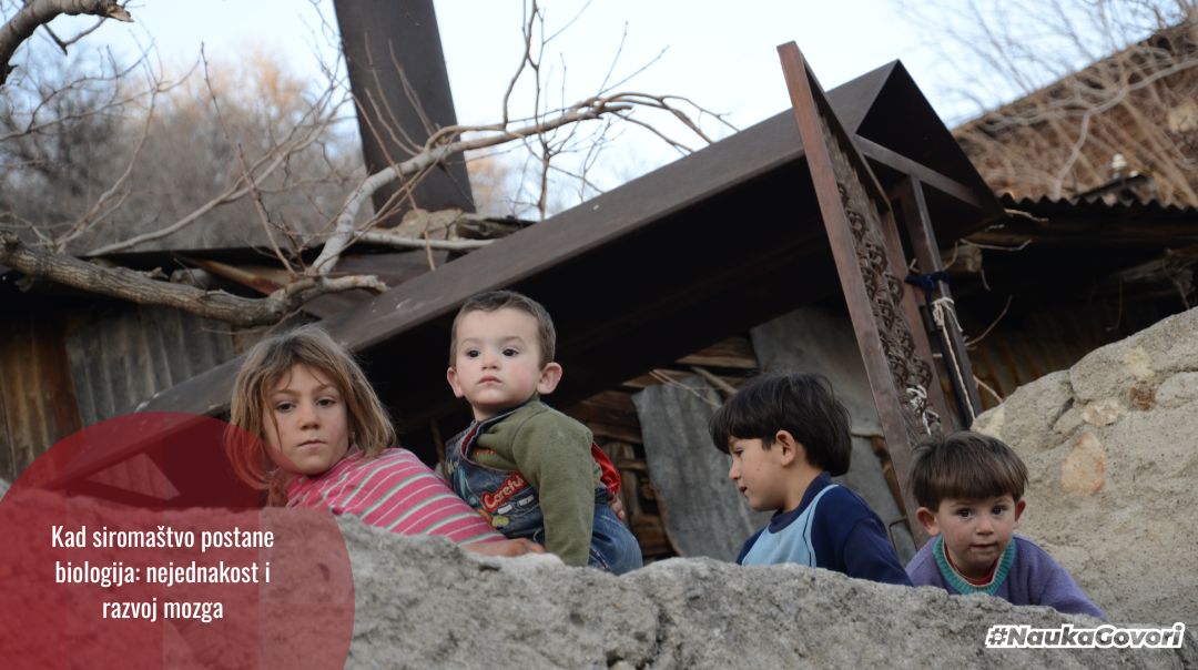 Nejednakost nije samo ekonomska – ona oblikuje i mozak